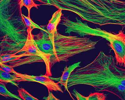 خلايا الدماغ التجدد كيفية التجديد الخلايا الدماغية الجديدة